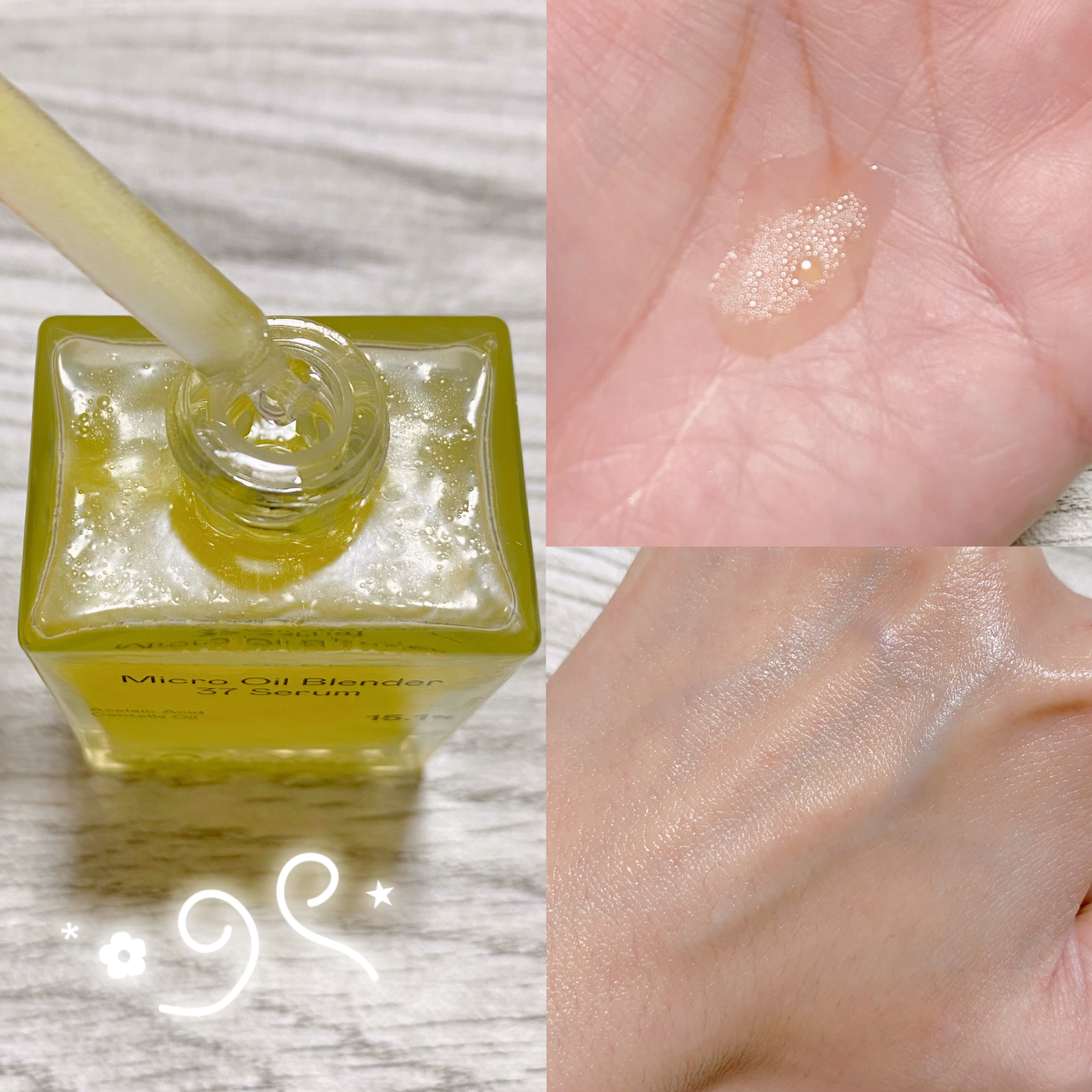 アゼライン酸CICA37セラム/オーズナリー/美容液を使ったクチコミ（2枚目）