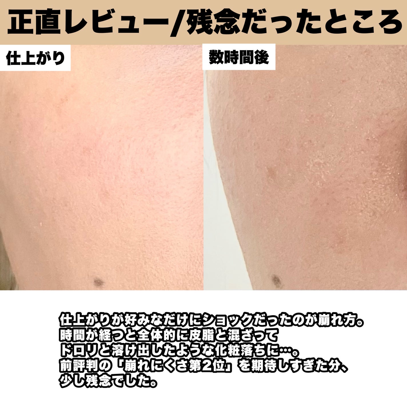 ãã©ããã£ãã¯ãšãã»ã³ã¹ã¯ãã·ã§ã³ ã°ããŠ/ããã¢ãŒãžã¥/ã¯ãã·ã§ã³ãã¡ã³ããŒã·ã§ã³ã䜿ã£ãã¯ãã³ãïŒ5æç®ïŒ