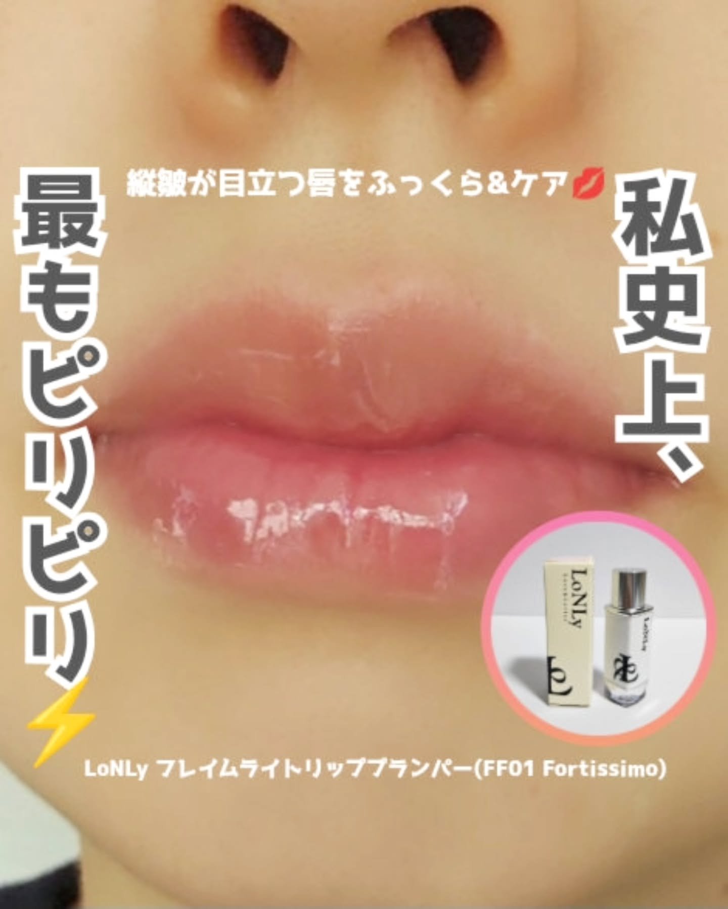 フレイムライトリッププランパー/LoNLy /リッププランパーを使ったクチコミ（1枚目）