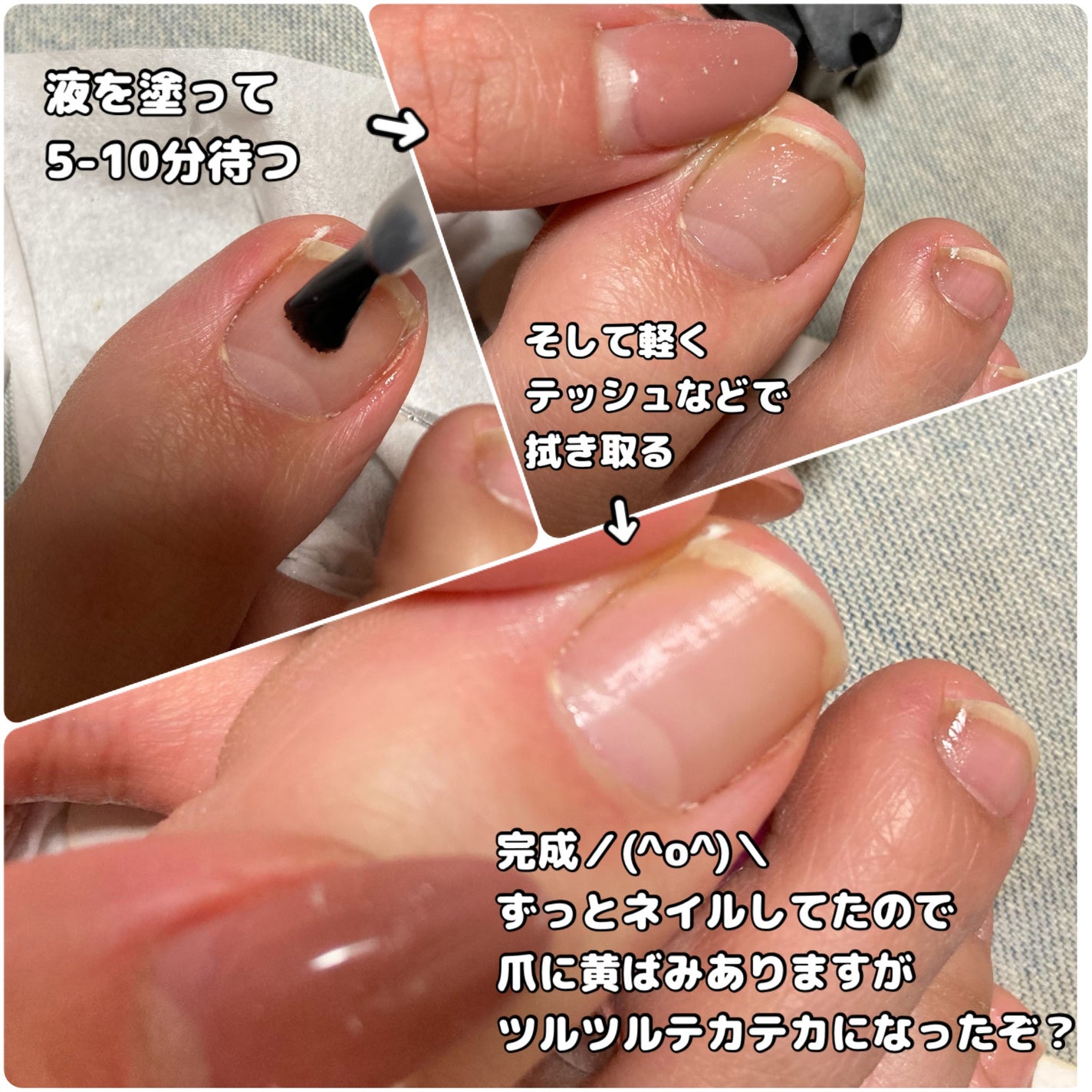 ベビーフット 足爪プロティンパック/ベビーフット/レッグ・フットケアを使ったクチコミ(4枚目)