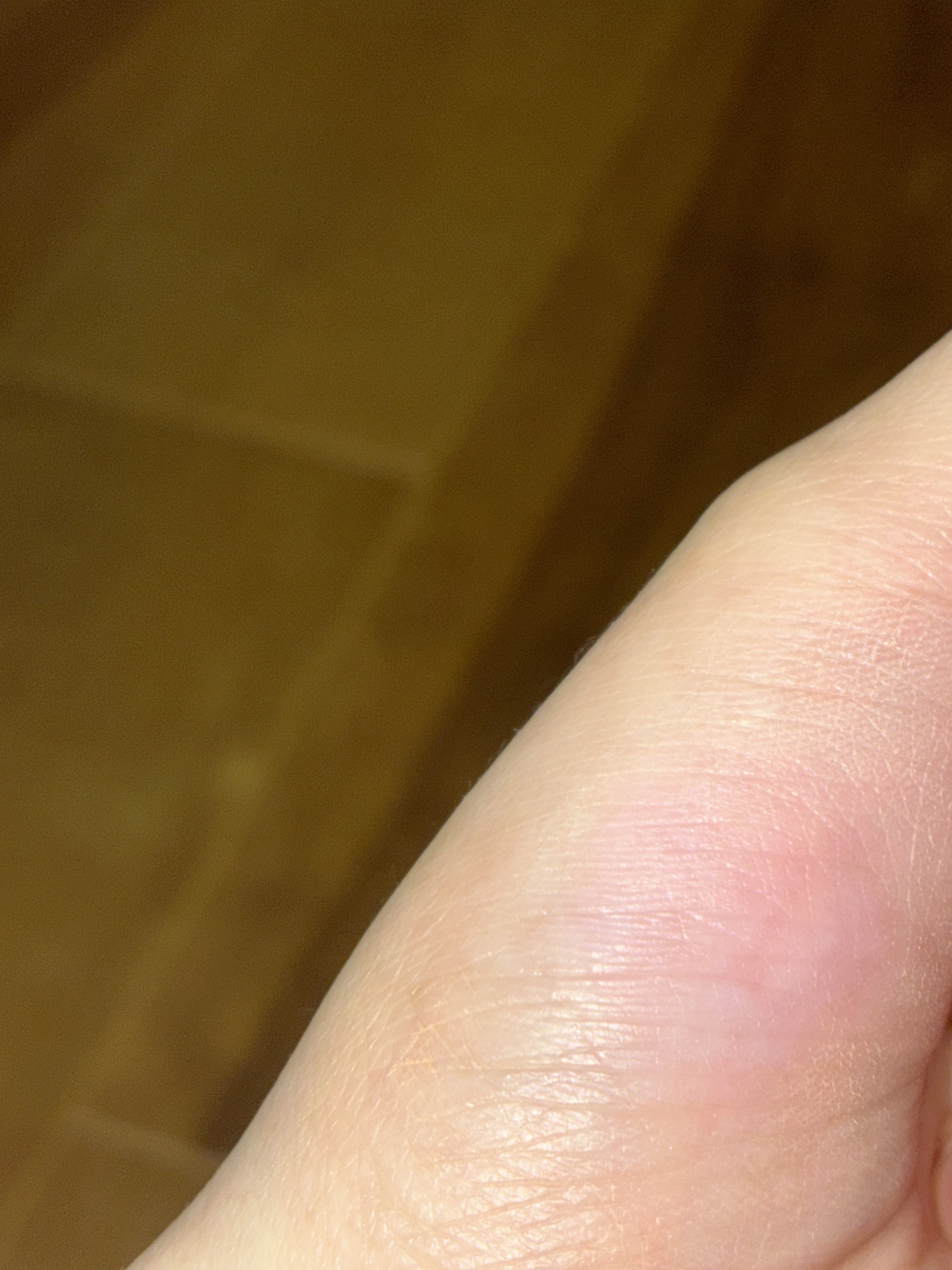 フルーティーリップジャム 06 ストロベリージャム/dasique/リップバームを使ったクチコミ（3枚目）