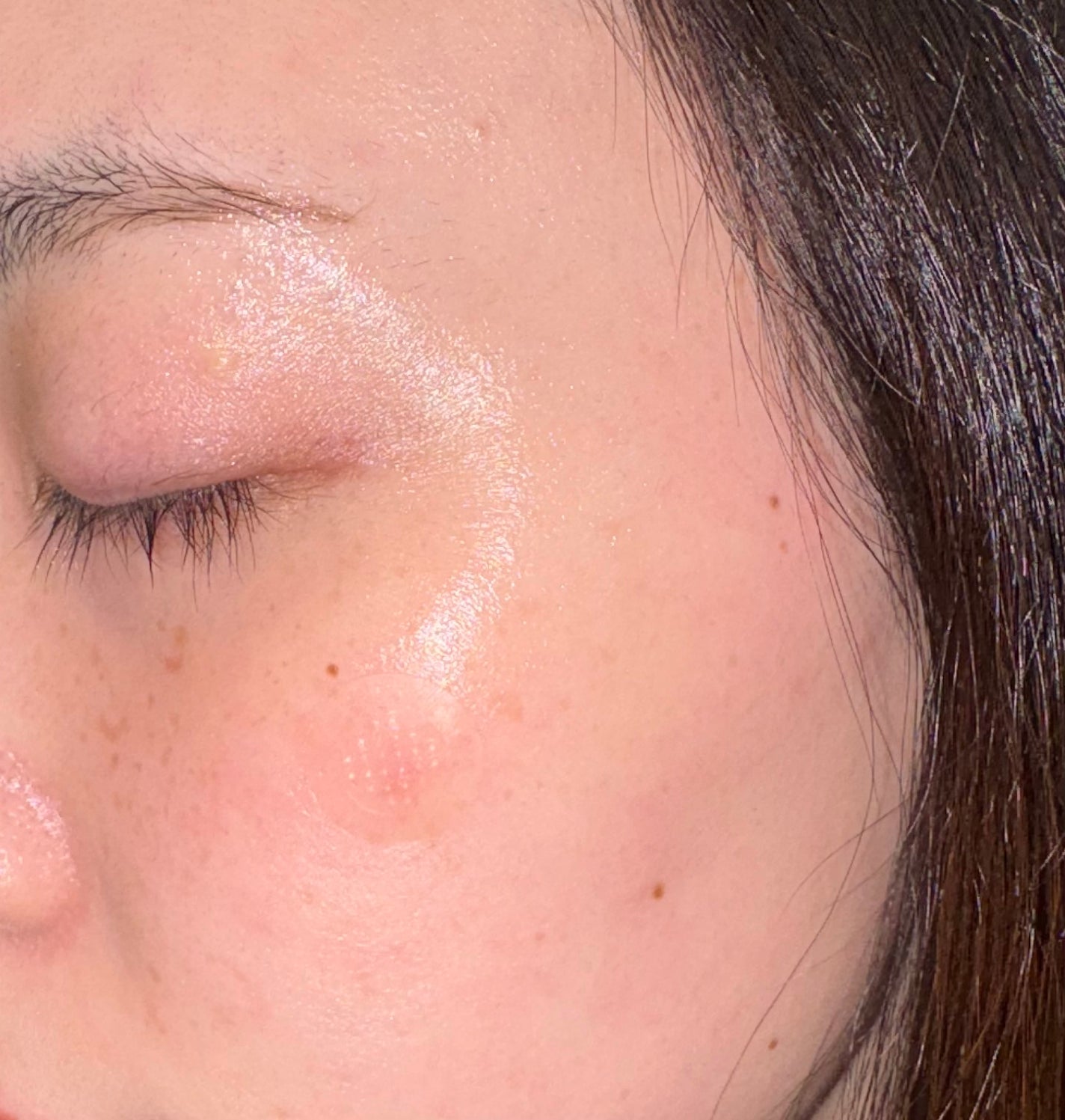 エイシーケアNE/ACROPASS/その他スキンケアを使ったクチコミ(5枚目)