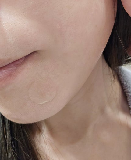 エイシーケアNE/ACROPASS/その他スキンケアを使ったクチコミ(4枚目)