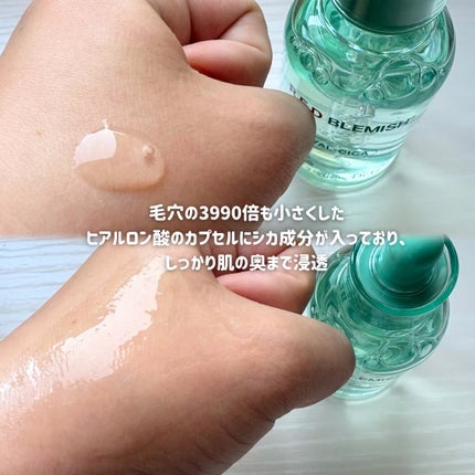 レッドブレミッシュ クリアスージングクリーム/Dr.G/フェイスクリームを使ったクチコミ(2枚目)