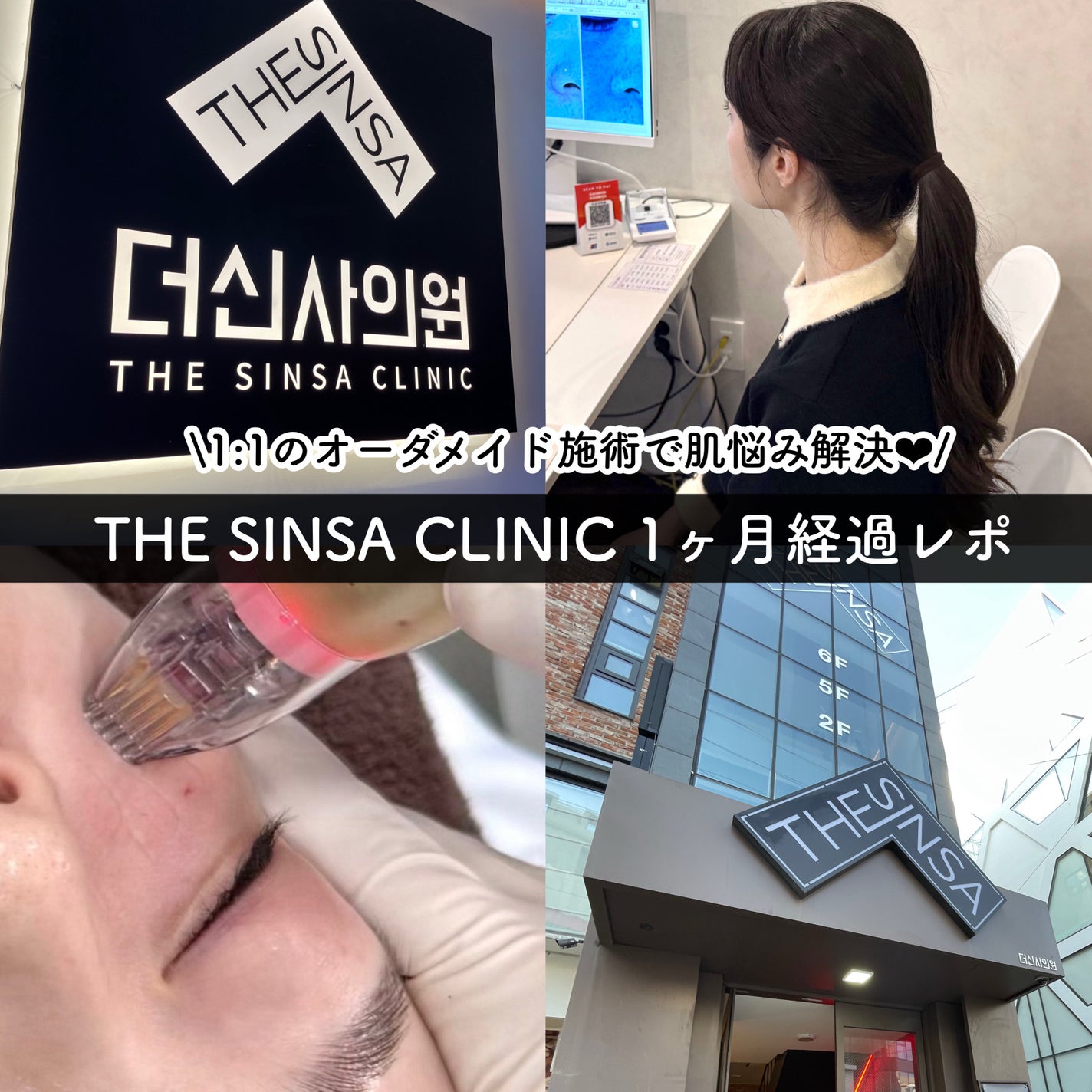 tobibi on LIPS 「1:1のオーダメイド治療で肌悩み解決/THESINSACLIN..」(1枚目)