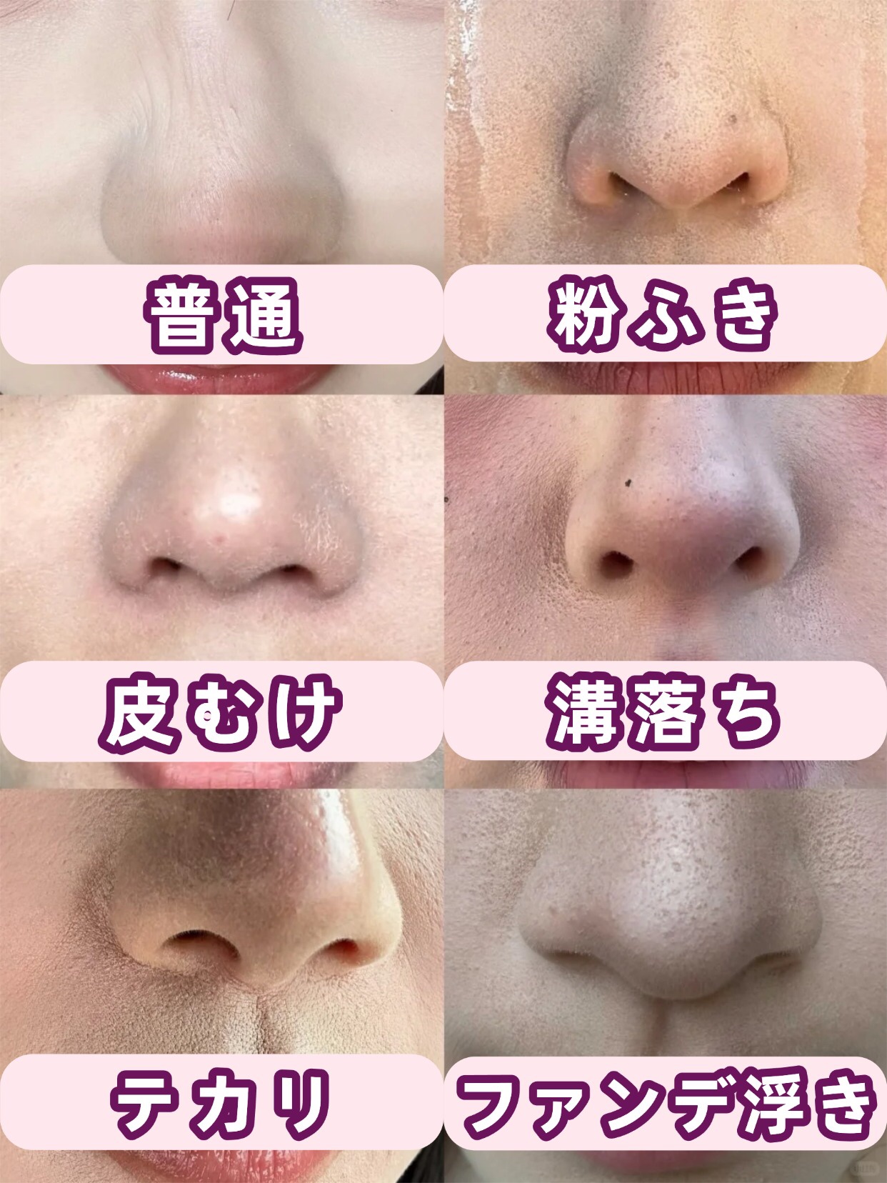 アネトス バランシング トリートメントクリーム/Anetos/フェイスクリームを使ったクチコミ（1枚目）