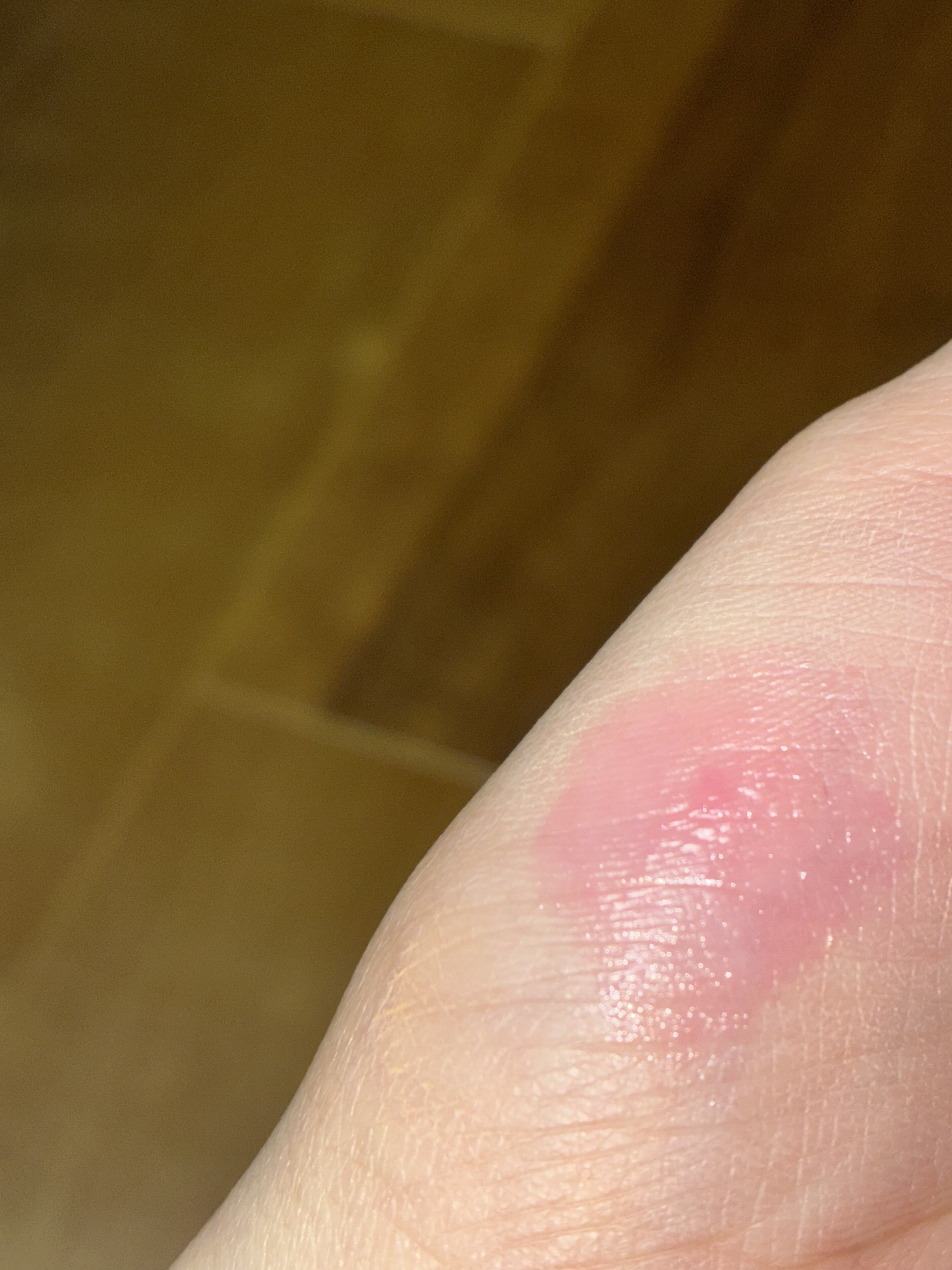 フルーティーリップジャム 06 ストロベリージャム/dasique/リップバームを使ったクチコミ（2枚目）