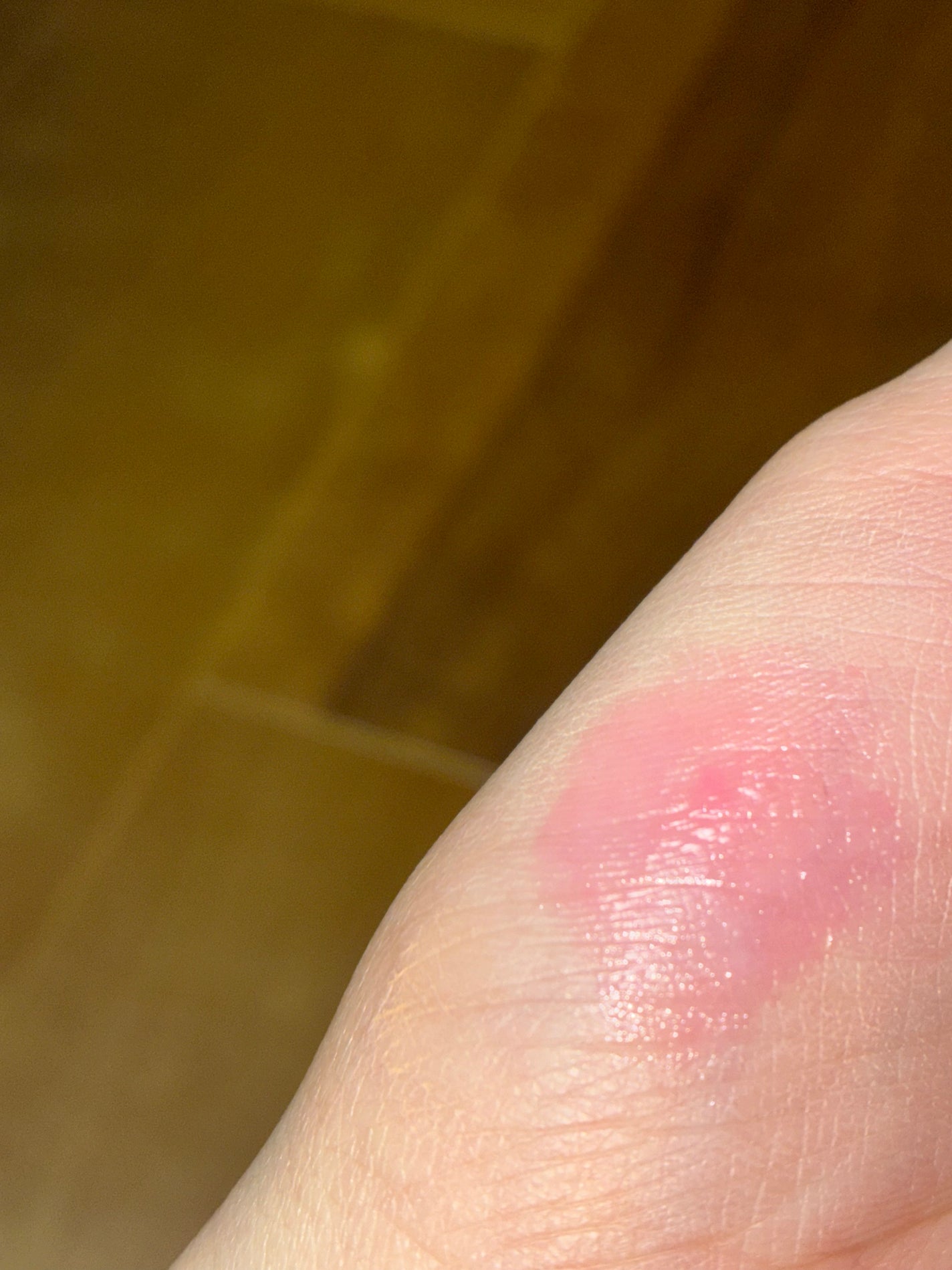 フルーティーリップジャム/dasique/リップバームを使ったクチコミ(2枚目)