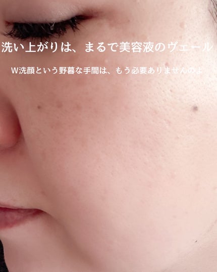 ビタバランスジェルクレンジング/.akaran/クレンジングジェルを使ったクチコミ(4枚目)