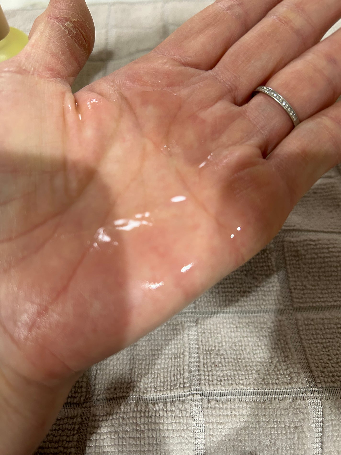 メソック ピールケアセラムVC/methoc/美容液を使ったクチコミ(3枚目)