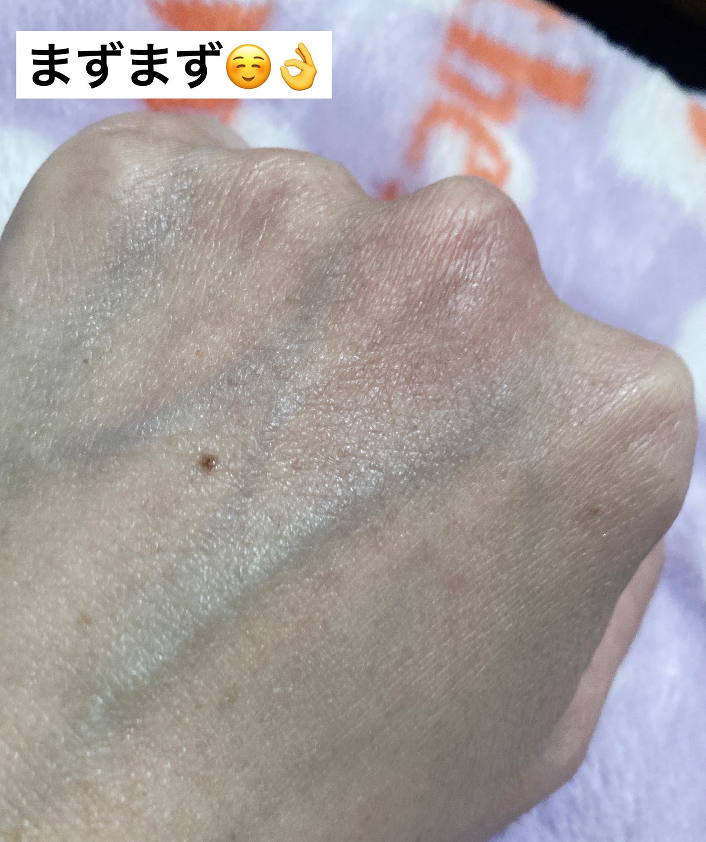 Remedies Five/イムノカーサ/美容液を使ったクチコミ(3枚目)