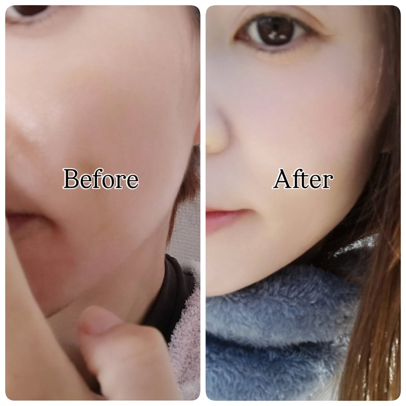 C×AZ ダーマインショット200/ESIENCE/美容液を使ったクチコミ(4枚目)