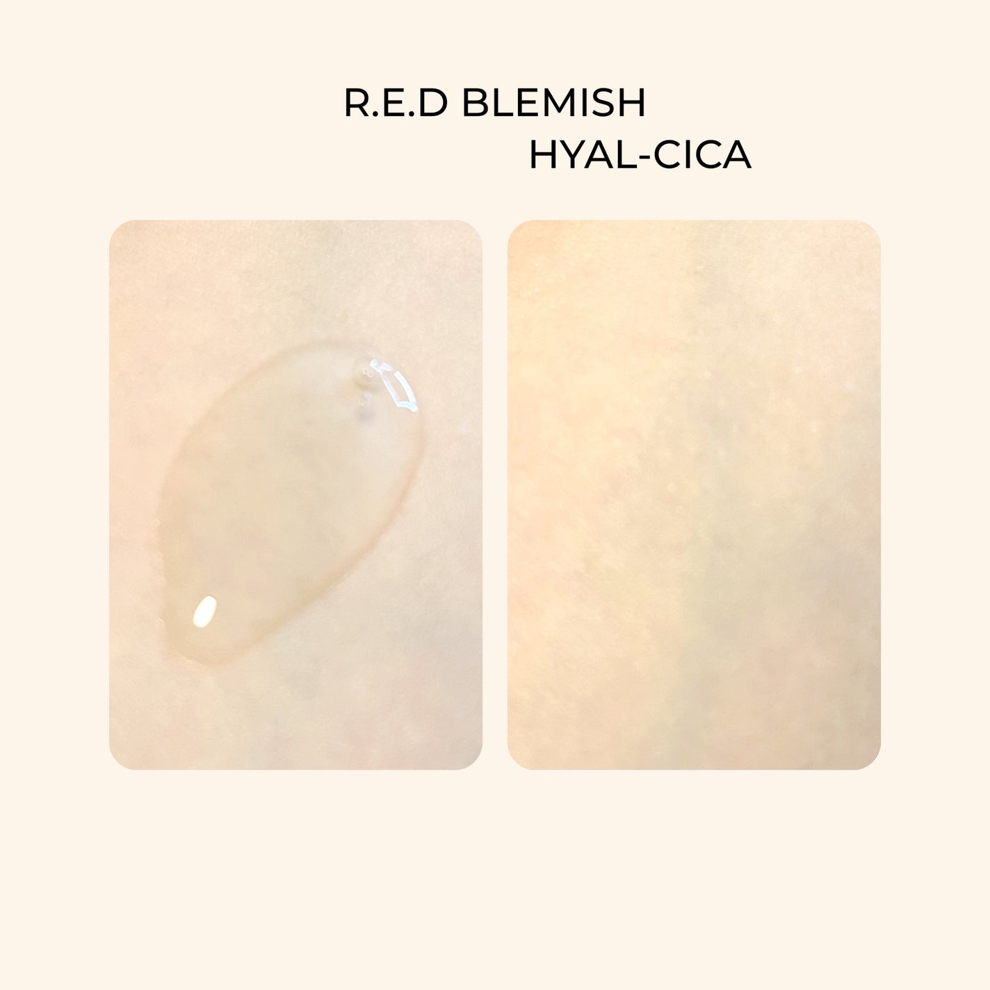 レッドブレミッシュ クリアヒアルシカスージングセラム/Dr.G/美容液を使ったクチコミ(2枚目)