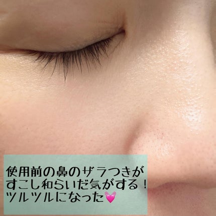 ティーツリーシカポアクレイパック/BRINGGREEN/洗い流すパック・マスクを使ったクチコミ(4枚目)