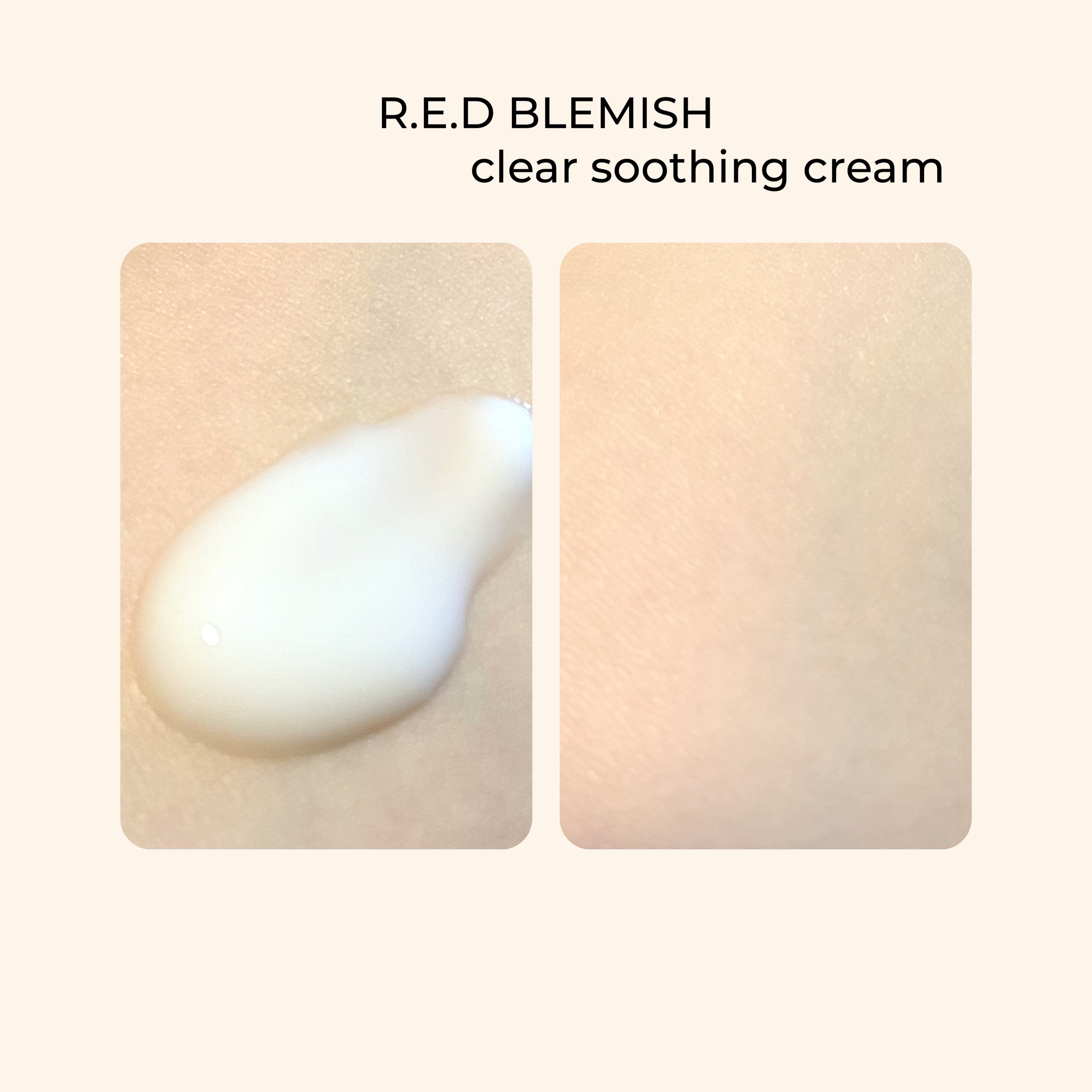 レッドブレミッシュ クリアスージングクリーム/Dr.G/フェイスクリームを使ったクチコミ（2枚目）