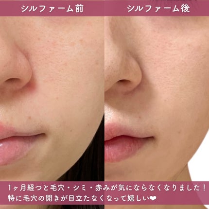 tobibi on LIPS 「1:1のオーダメイド治療で肌悩み解決/THESINSACLIN..」(5枚目)