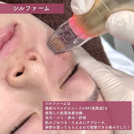 tobibi on LIPS 「1:1のオーダメイド治療で肌悩み解決/THESINSACLIN..」(4枚目)