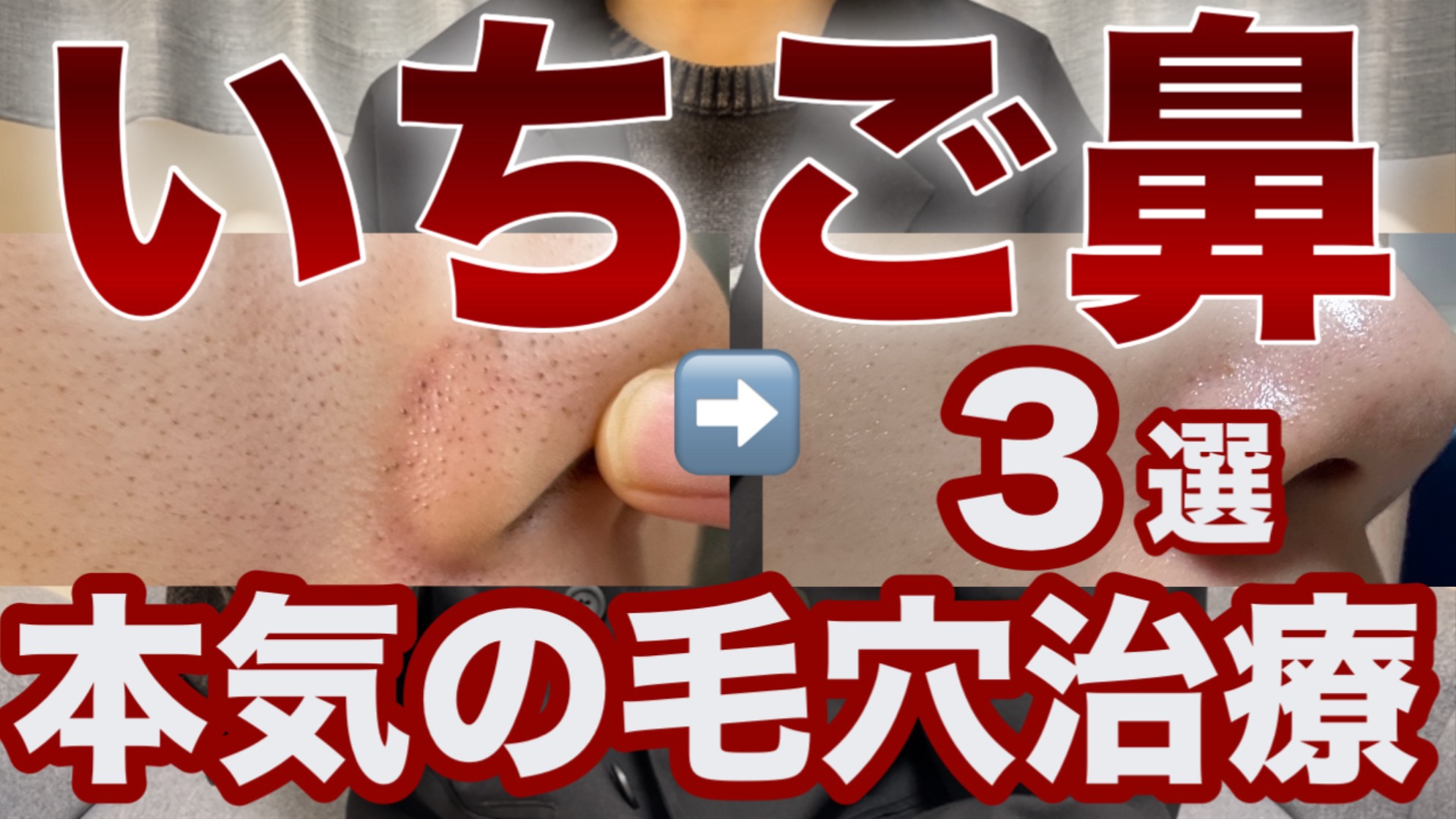 土曜日のYouTubeはコチラ✩.*˚

#美容医療 #美容皮膚科 #スキンケア #インナードライ 