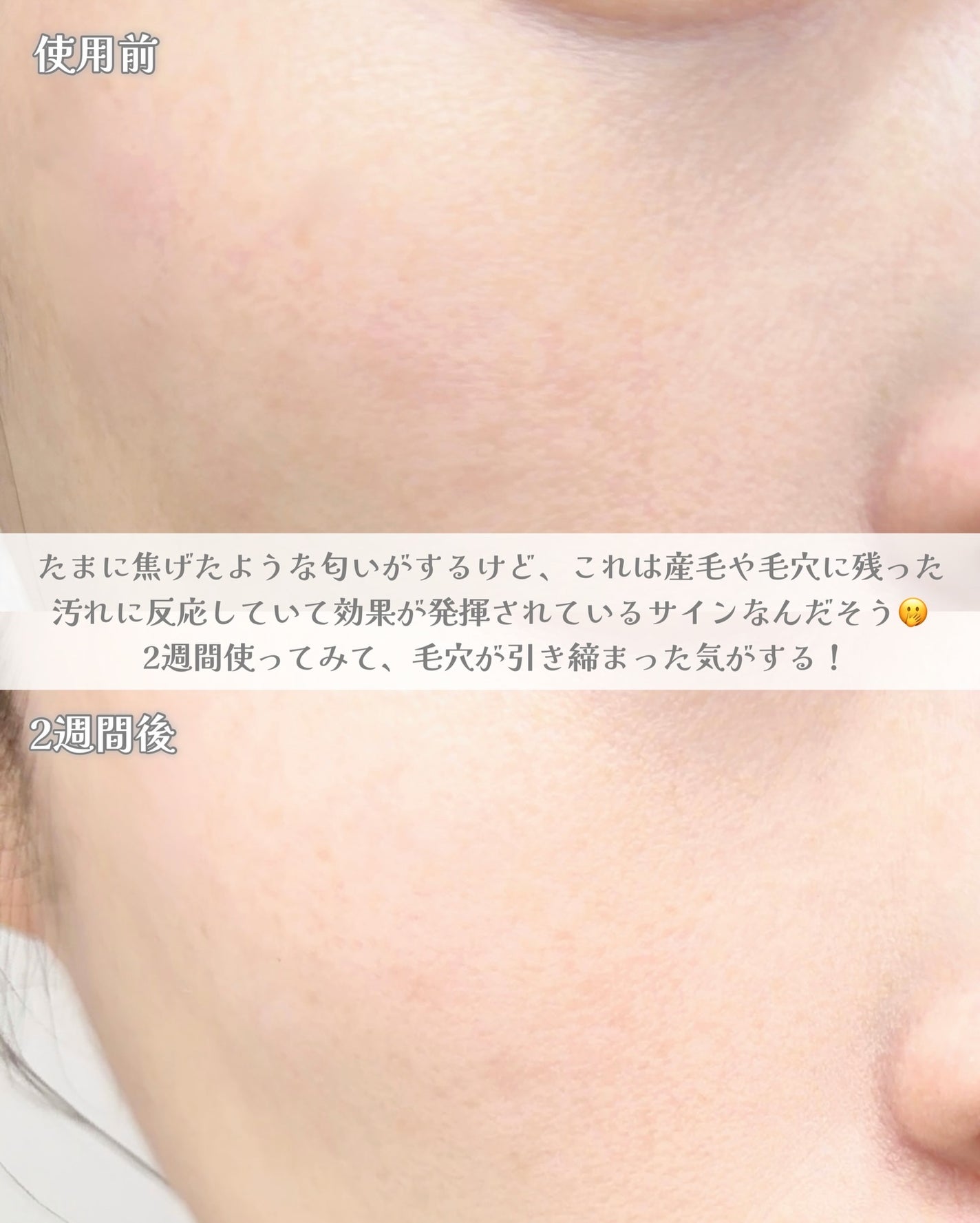 ペンタショット/CELORABY/美顔器・マッサージを使ったクチコミ(3枚目)