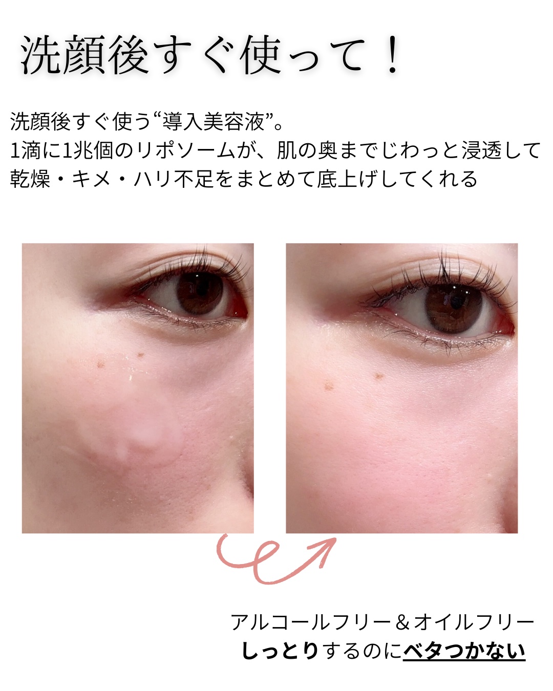 リポソーム アドバンスト　リペアセラム/DECORTÉ/美容液を使ったクチコミ（2枚目）