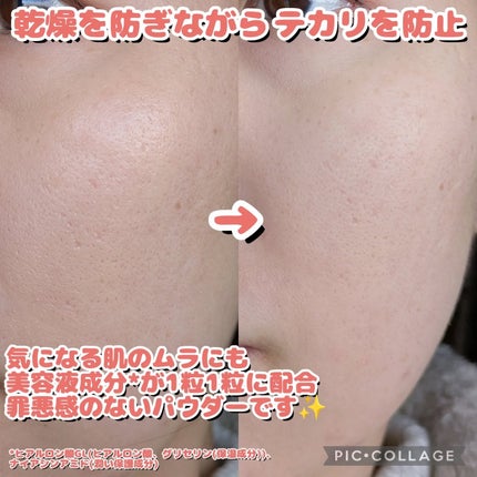 SHISEIDO ãšãã»ã³ã¹ ã¹ãã³ã»ããã£ã³ã° ããŠããŒ/SHISEIDO/ã«ãŒã¹ããŠããŒã䜿ã£ãã¯ãã³ãïŒ5æç®ïŒ