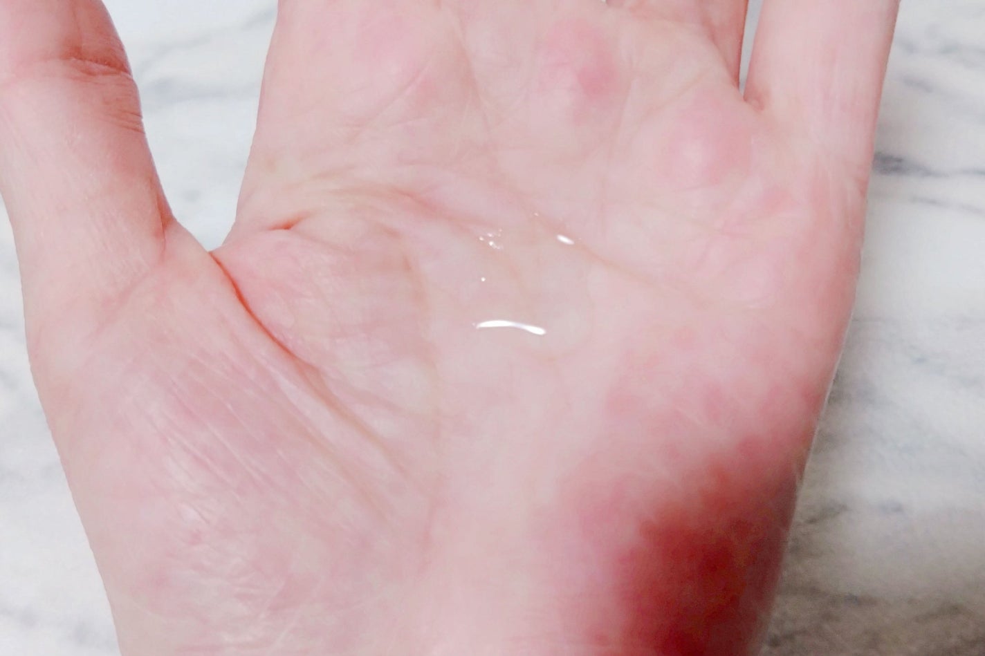 レッドブレミッシュ クリアスージングトナー/Dr.G/化粧水を使ったクチコミ(4枚目)