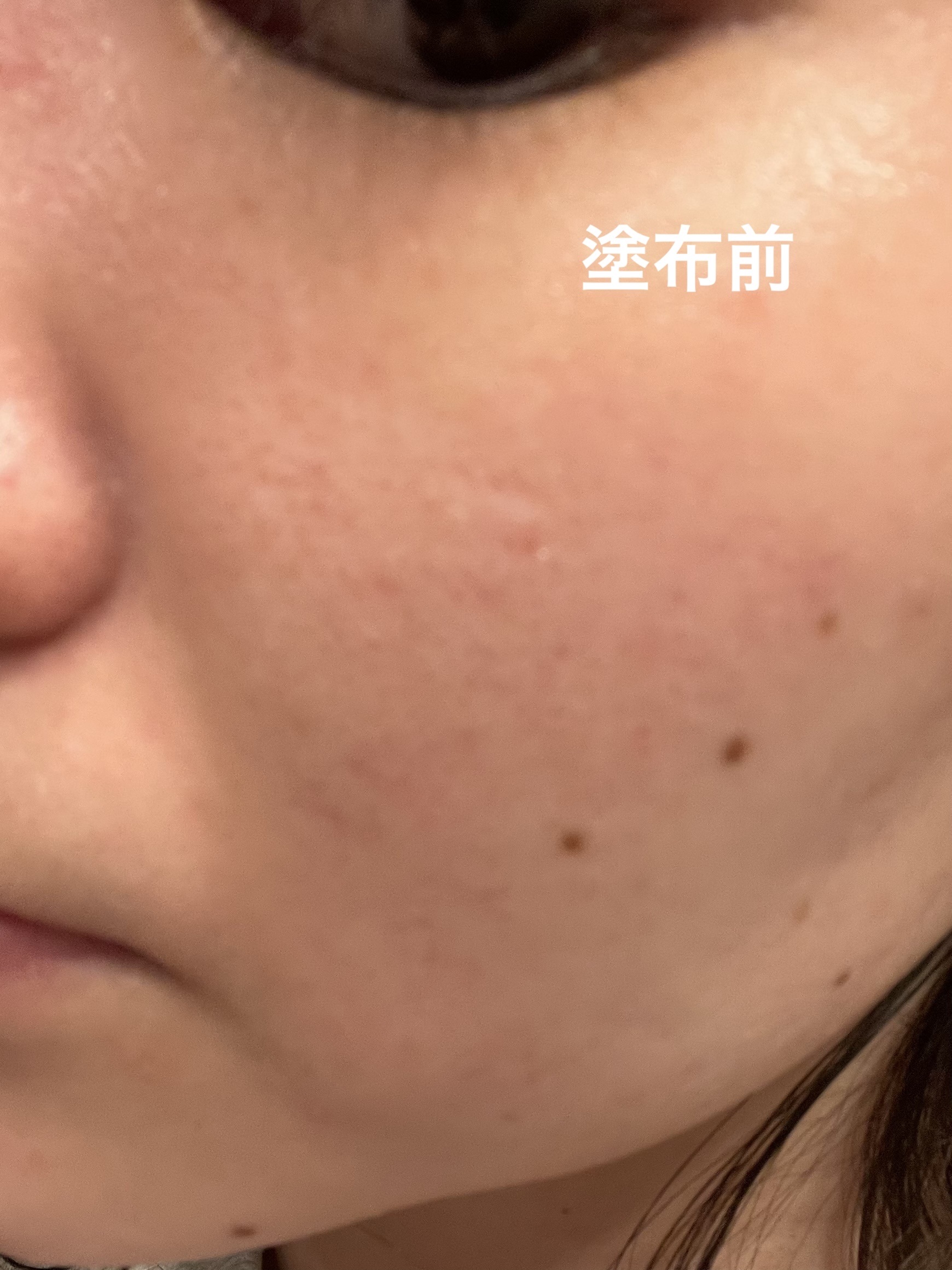 セルフホワイトニング ミッション/ALBION/美容液を使ったクチコミ（2枚目）