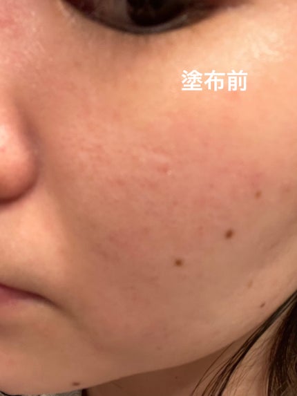 セルフホワイトニング ミッション/ALBION/美容液を使ったクチコミ(2枚目)