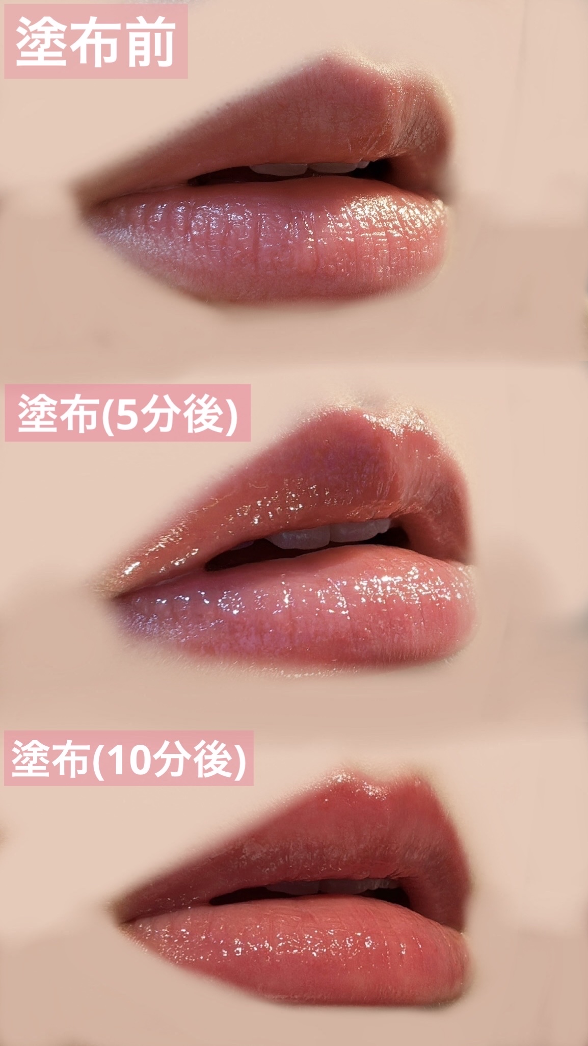 ボリュームリッププランパー/BANILA CO/リッププランパーを使ったクチコミ（2枚目）