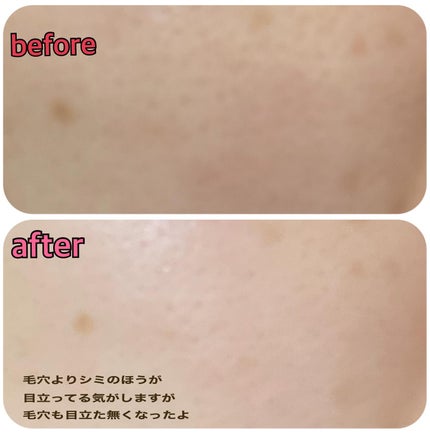 ブラックチェリー 毛穴引き締めクリーム ロフディ/ODELOI/フェイスクリームを使ったクチコミ(2枚目)