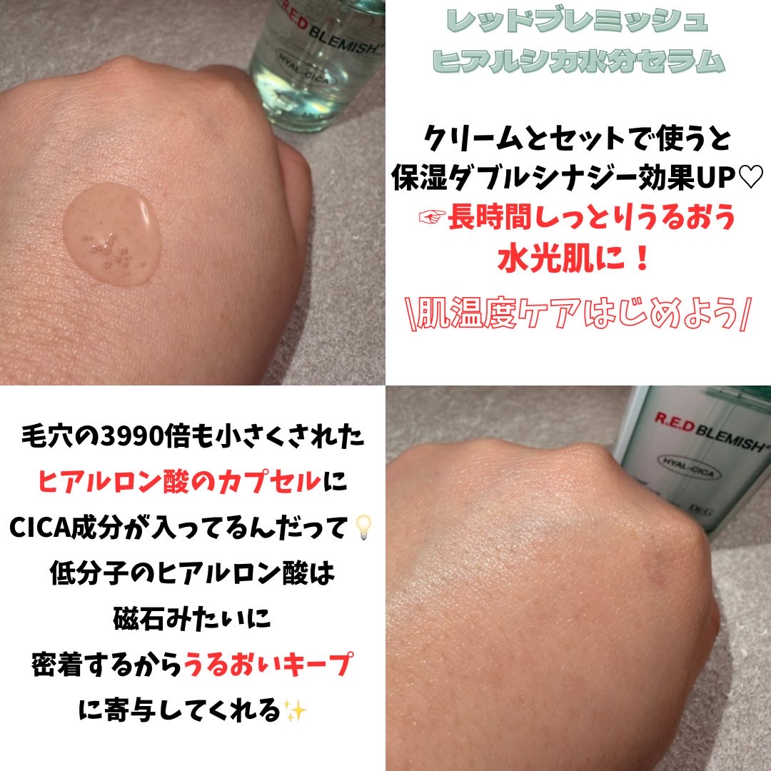 レッドブレミッシュ クリアスージングクリーム/Dr.G/フェイスクリームを使ったクチコミ（3枚目）