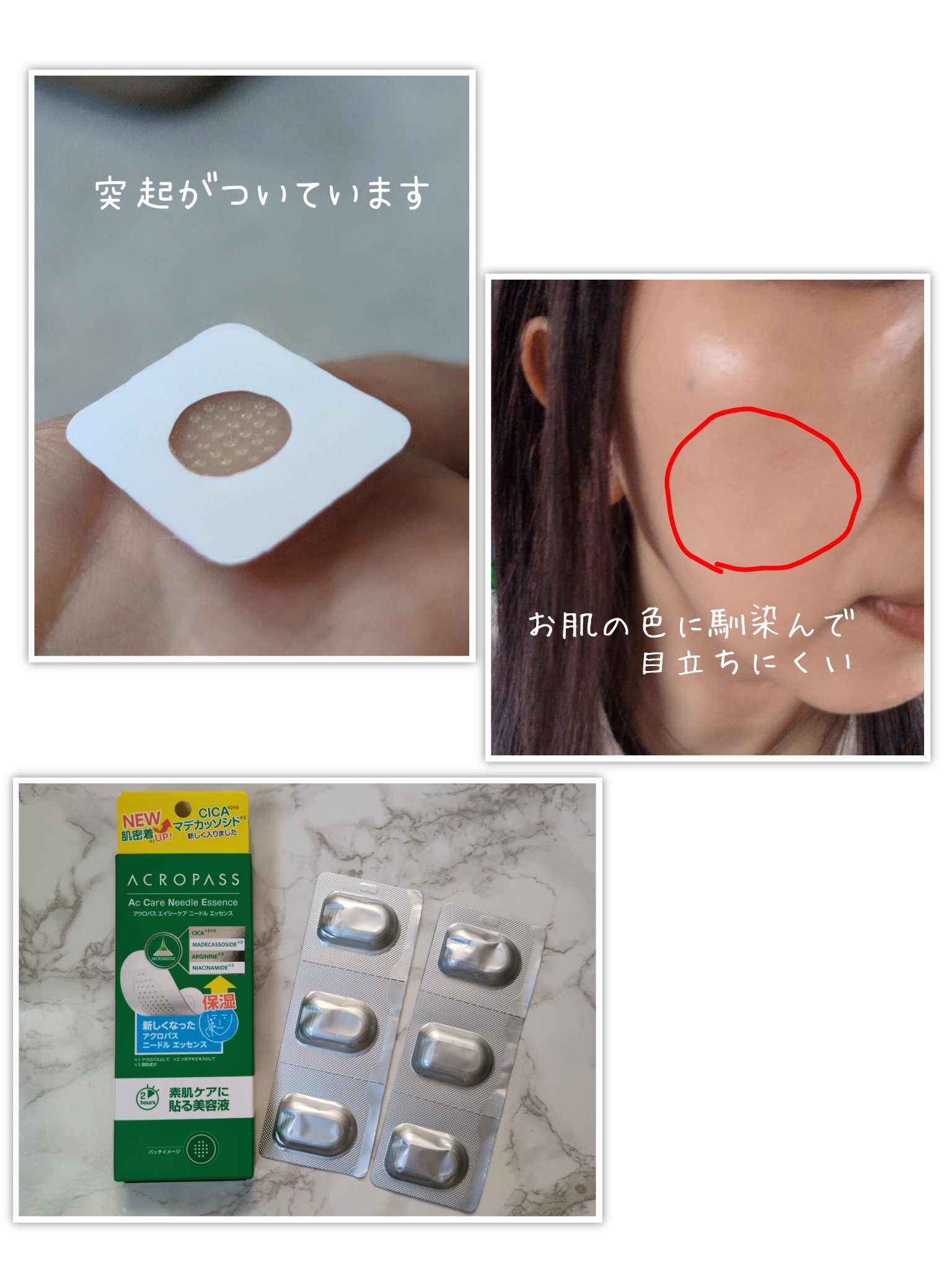 エイシーケアNE/ACROPASS/その他スキンケアを使ったクチコミ（2枚目）