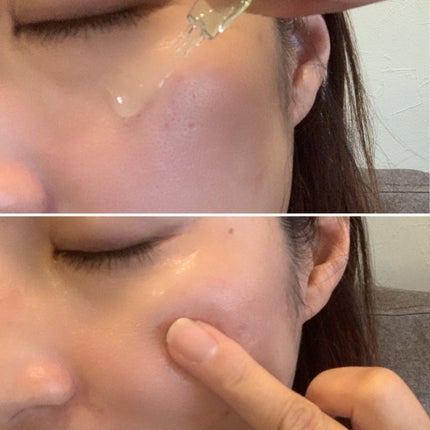 クラウドアンプル 1week キット/CHARDE/美容液を使ったクチコミ(5枚目)