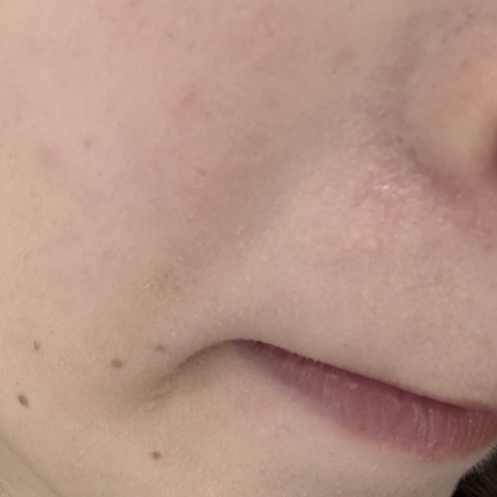 乾燥さん 保湿力プロテクトパウダー/乾燥さん/プレストパウダーを使ったクチコミ（3枚目）