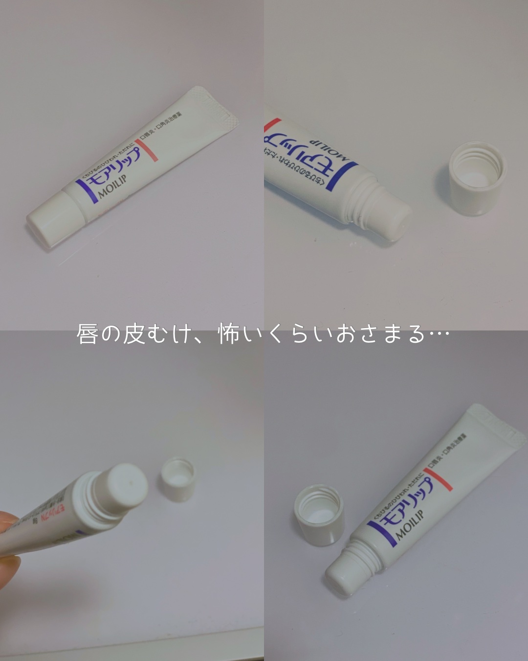 モアリップ N (医薬品)/資生堂薬品/その他を使ったクチコミ（1枚目）
