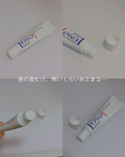 モアリップ N (医薬品)/資生堂薬品/その他を使ったクチコミ(1枚目)