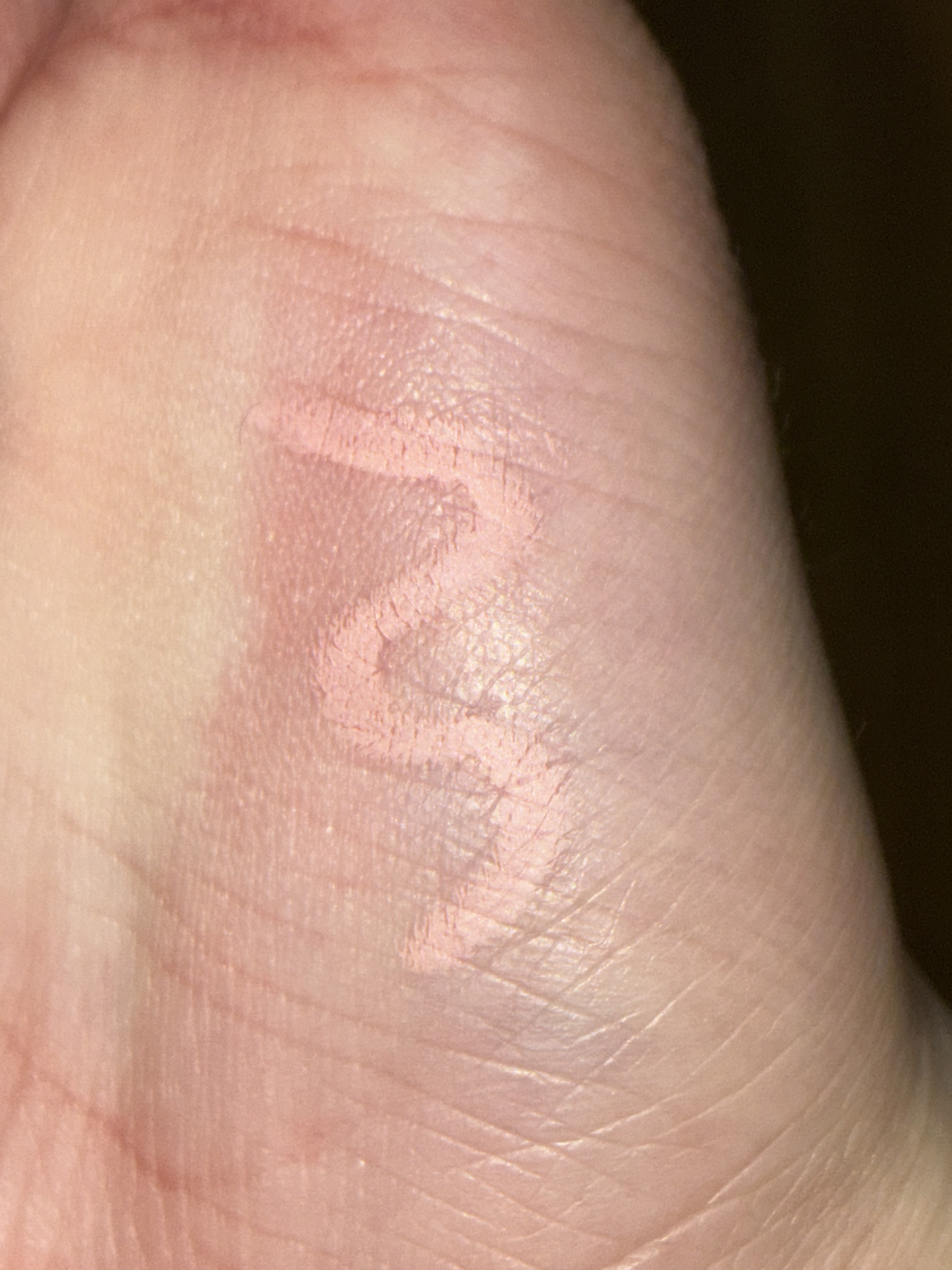 ポイントコンシーラー/CipiCipi/ペンシルコンシーラーを使ったクチコミ（2枚目）