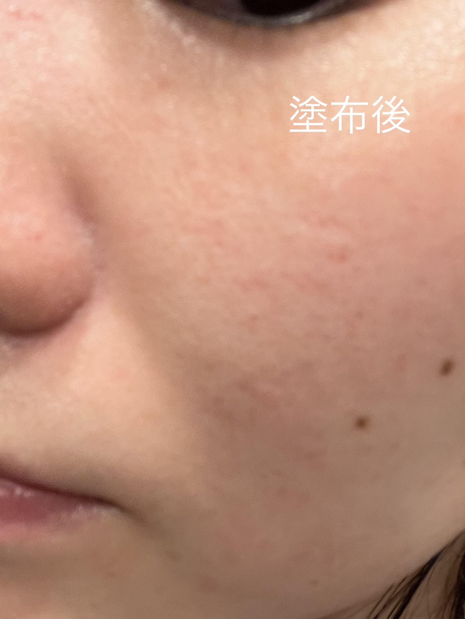 セルフホワイトニング ミッション/ALBION/美容液を使ったクチコミ（3枚目）