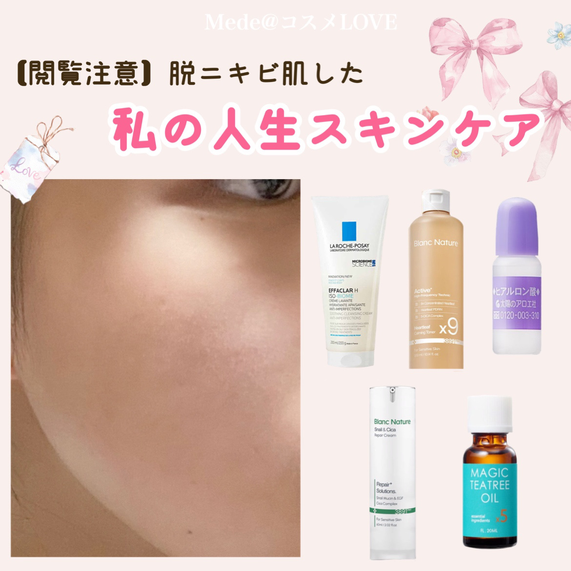 ヒアルロン酸原液/太陽のアロエ社/美容液を使ったクチコミ（1枚目）