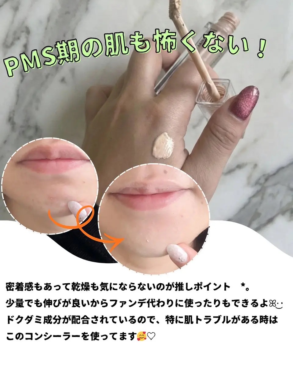 ダーマシンコンシーラー/23years old/リキッドコンシーラーを使ったクチコミ（3枚目）