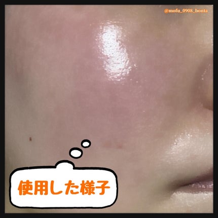 ビタ3セラム/オーズナリー/美容液を使ったクチコミ(5枚目)