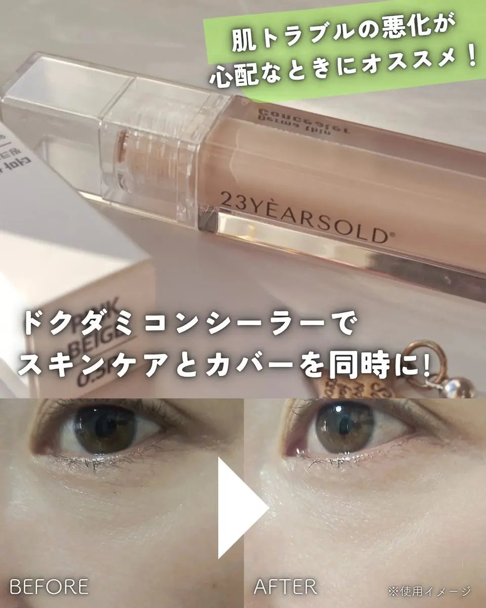 ダーマシンコンシーラー/23years old/リキッドコンシーラーを使ったクチコミ（1枚目）