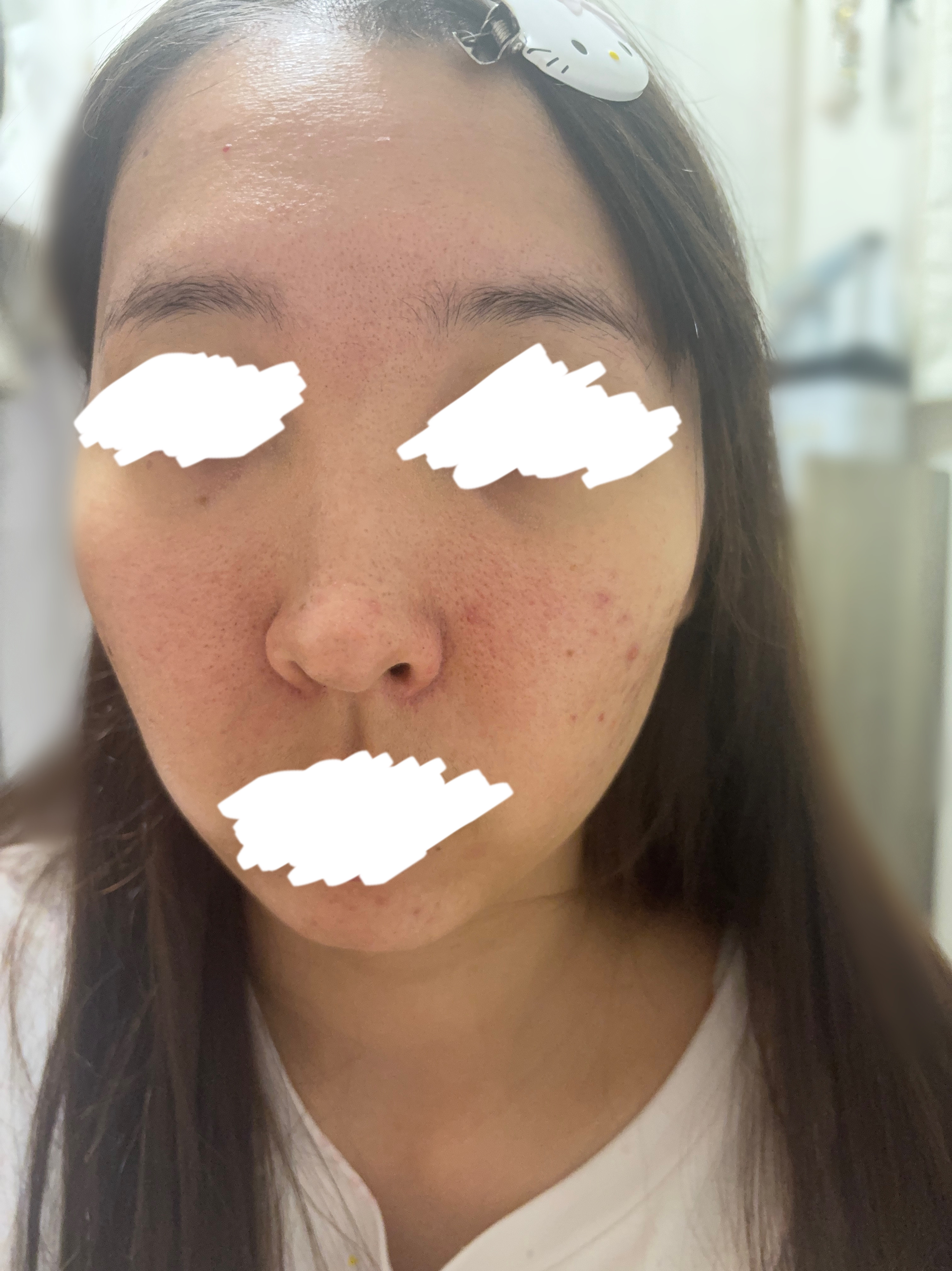 ピールソープ AHA/プラスキレイ/洗顔石鹸を使ったクチコミ（2枚目）