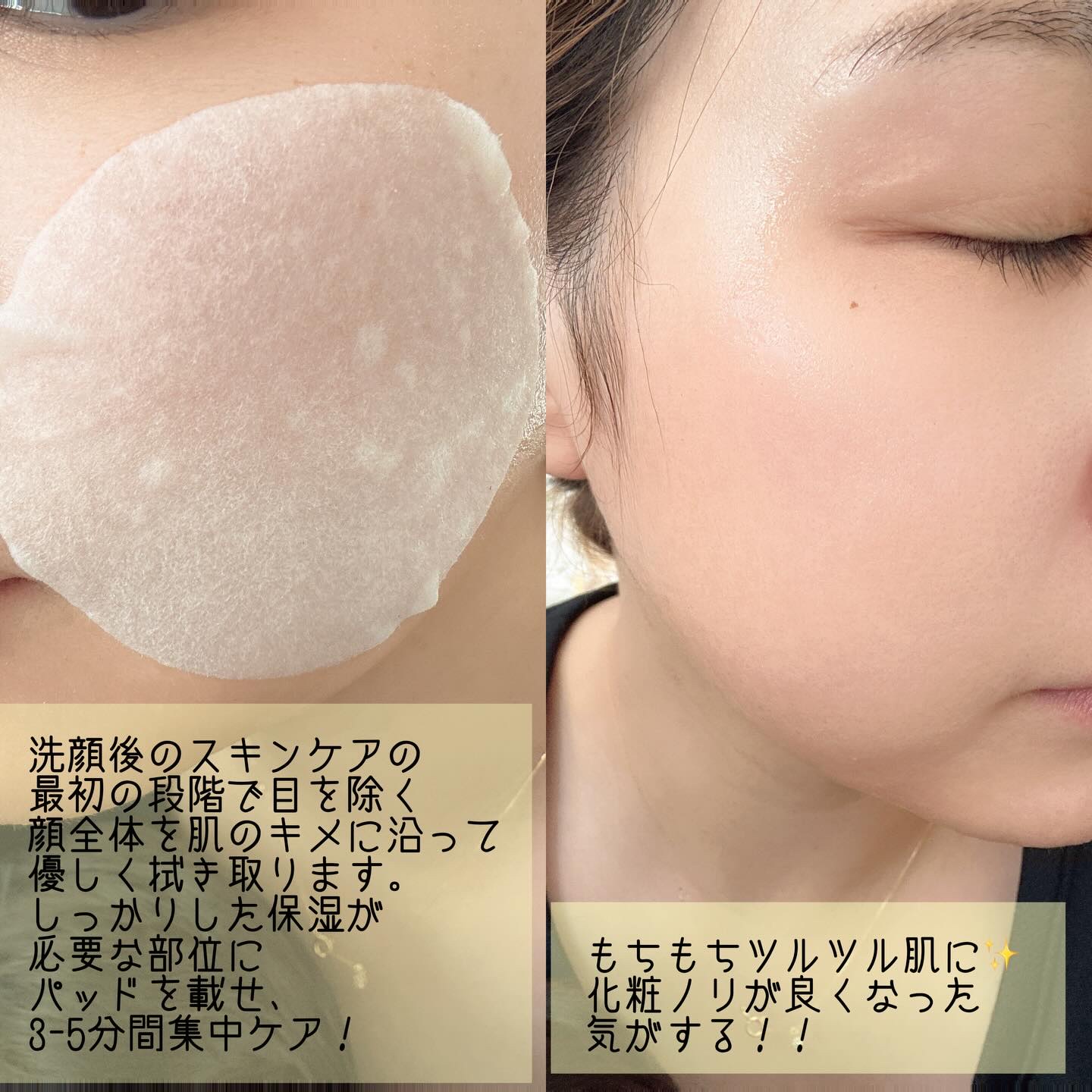 ACモイスチャートナーパッド /BRINGGREEN/拭き取り化粧水を使ったクチコミ（3枚目）