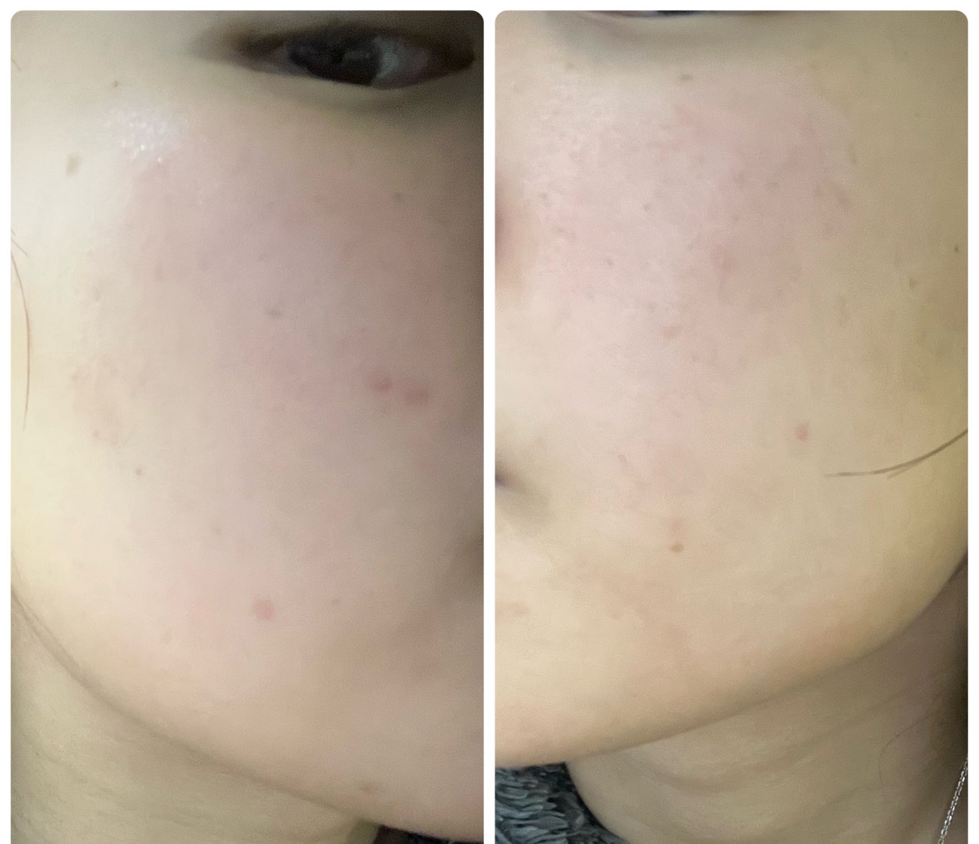 ぽむ on LIPS 「1枚目 2026.1.6エピデュオ 846日目2枚目 2026..」(2枚目)