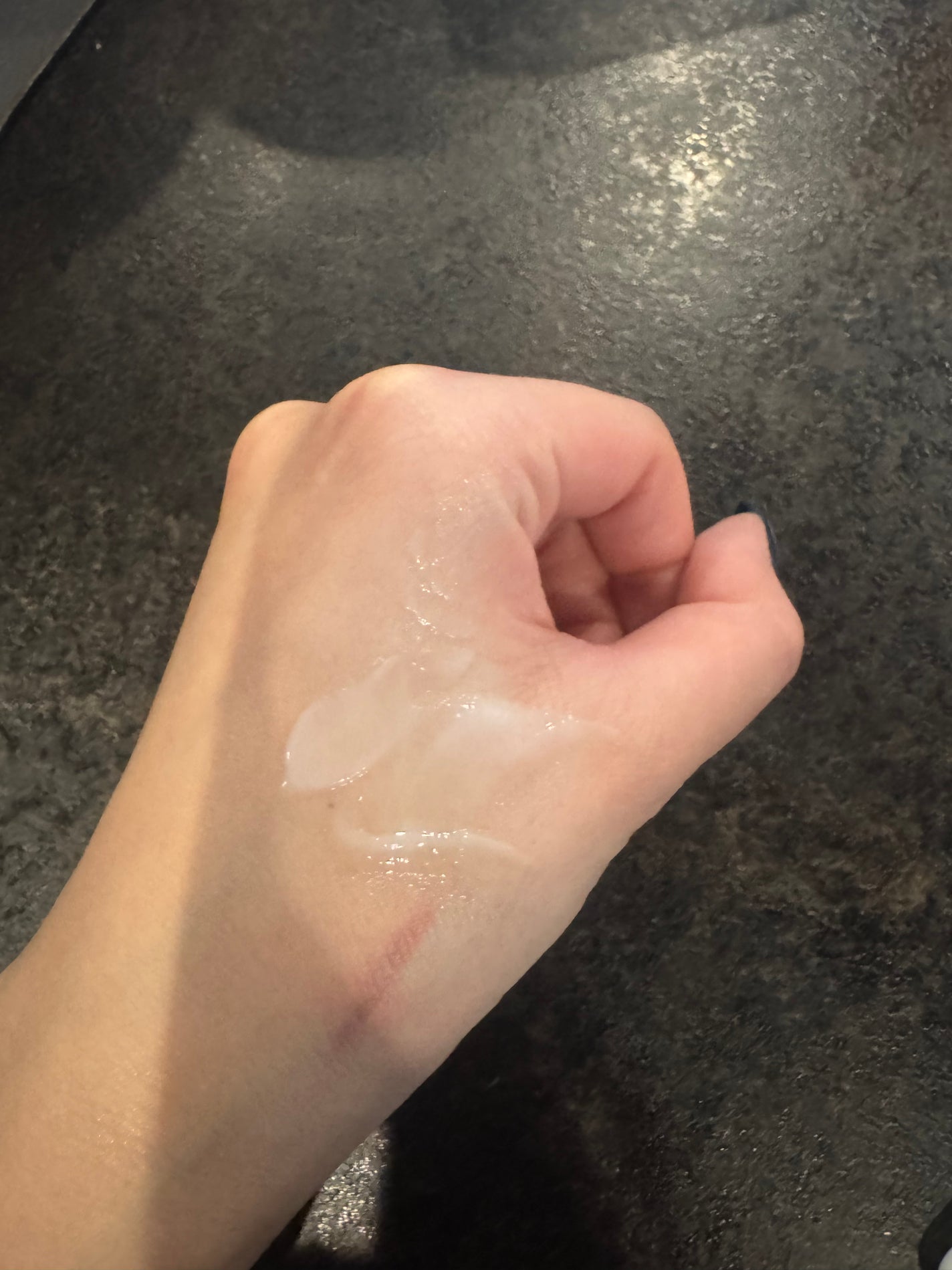 メラピールクリームマスク/CHARDE/ピーリングを使ったクチコミ(3枚目)