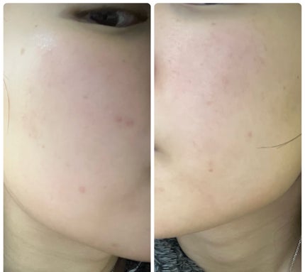 を使ったクチコミ(3枚目)