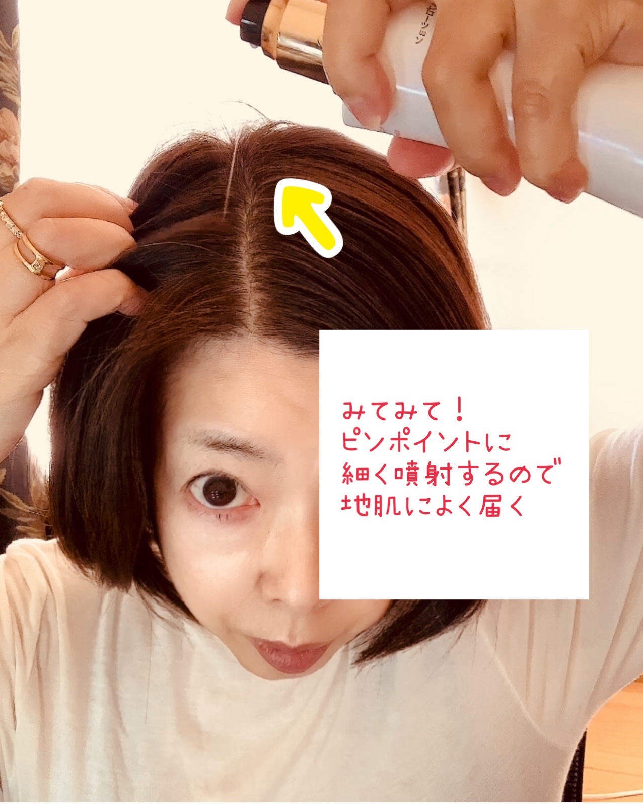 スカルプローション/Rintor/頭皮ローションを使ったクチコミ（3枚目）