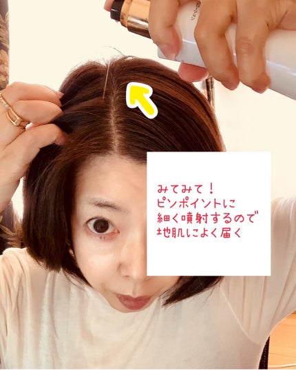 スカルプローション/Rintor/頭皮ローションを使ったクチコミ(3枚目)