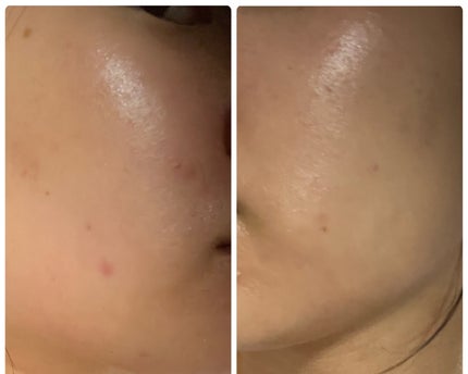 を使ったクチコミ(1枚目)